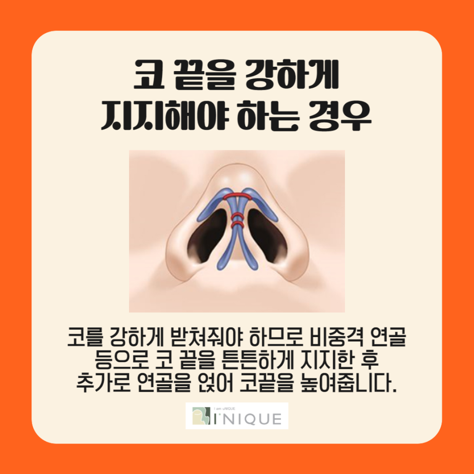 Attention if You're Looking for a Place That Does Nose Tip Surgery Well! image 3