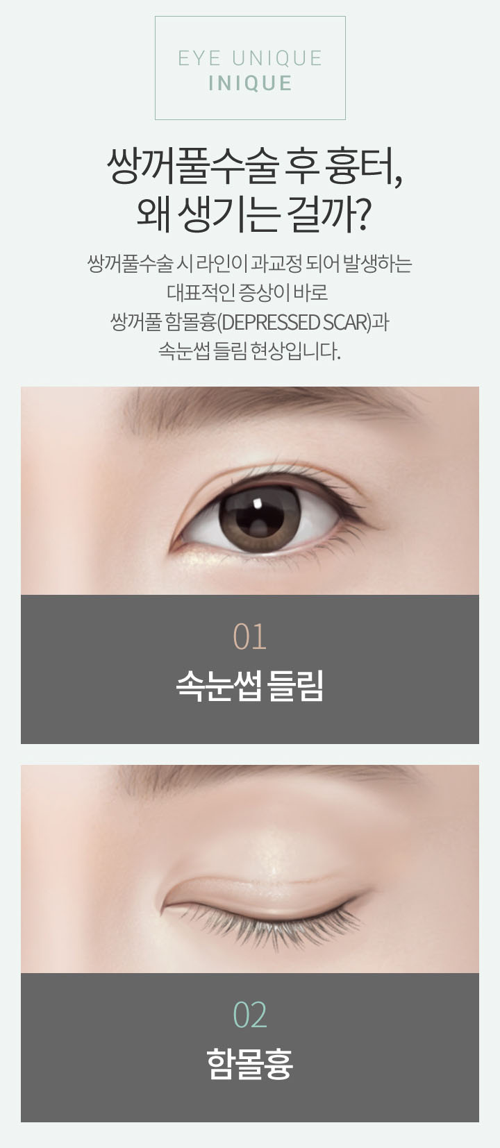 속눈썹들림 더 이상 고민하지 마세요! 관련 이미지 2