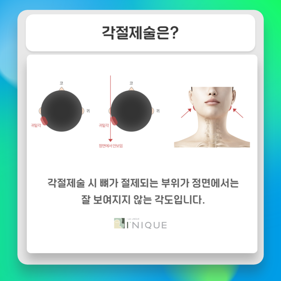 Key Points of Facial Contouring Surgery image 4