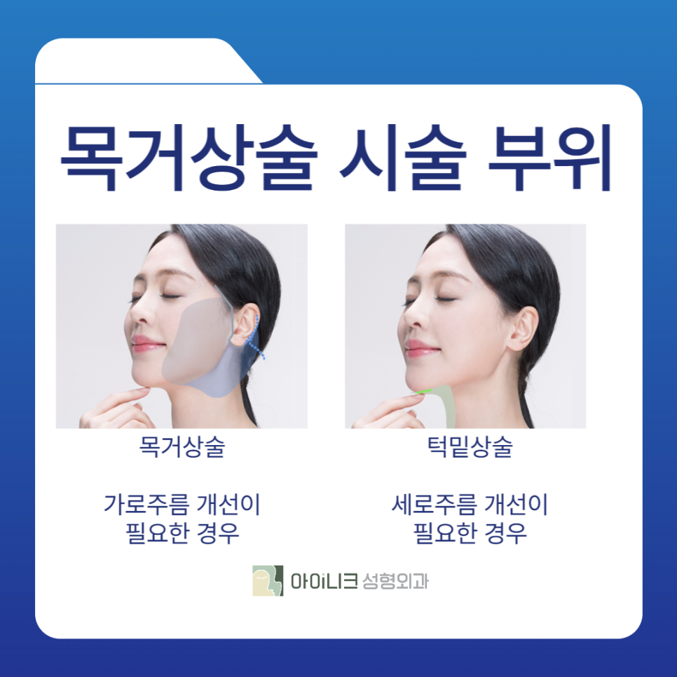 Neck Wrinkle Plastic Surgery: I Solved the Cause of an Aged Appearance image 2