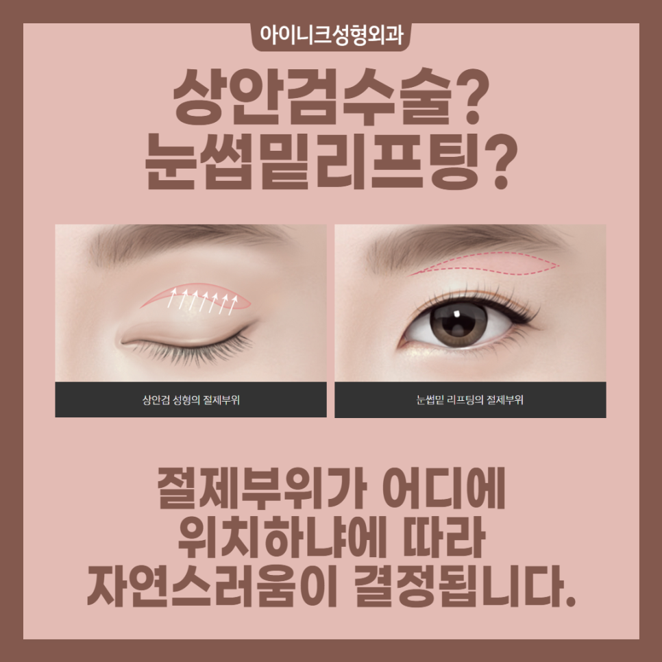 중년성형외과 확실한 효과를 원한다면? 관련 이미지 3