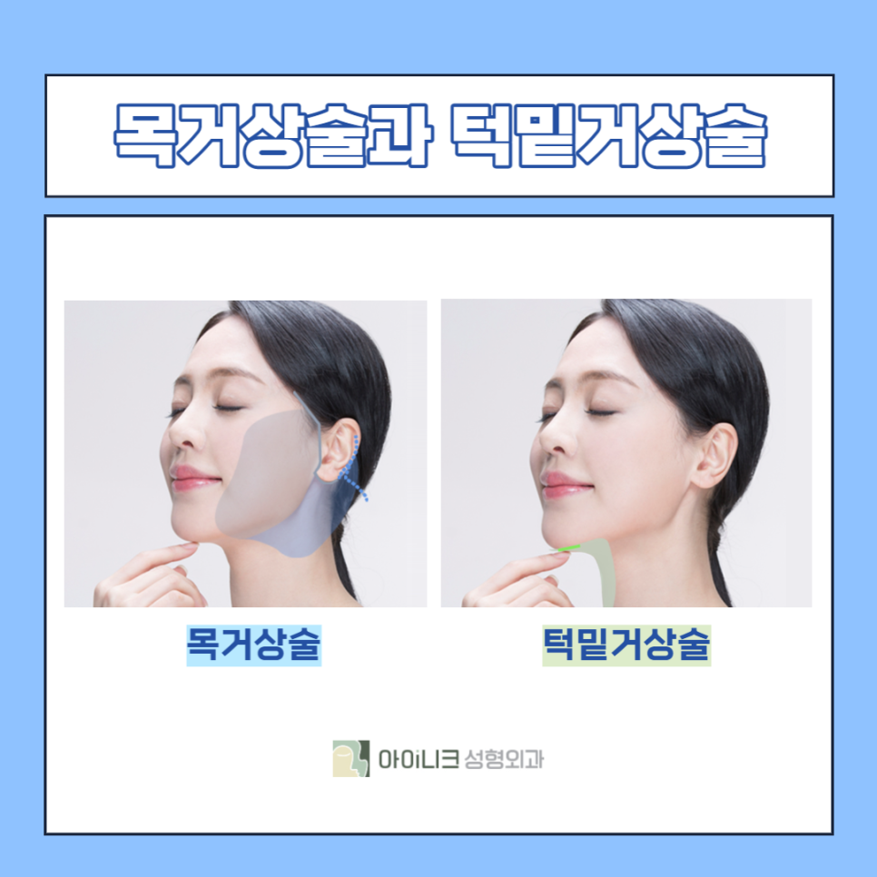 안면거상술잘하는곳 찾는다면 주목하세요! 관련 이미지 5