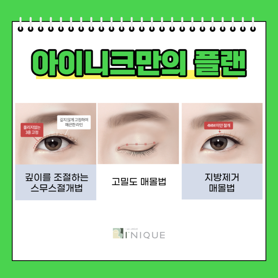 쌍꺼풀병원, 중요한 건 경험과 노하우! 관련 이미지 3