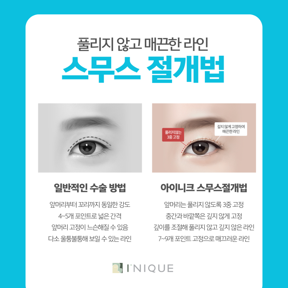 5 Care Tips You Must Follow After Double Eyelid Surgery in Gangnam image 6