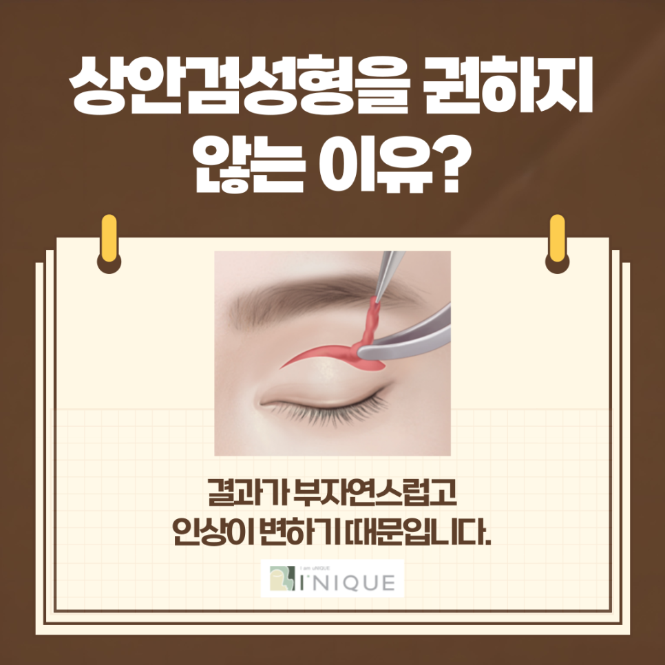 중년남성눈성형도 자신있게! 관련 이미지 4
