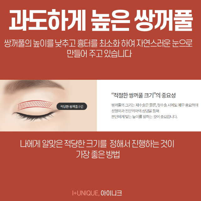 처음만큼 신중해야 하는 쌍꺼풀재수술잘하는병원 고르기 관련 이미지 4