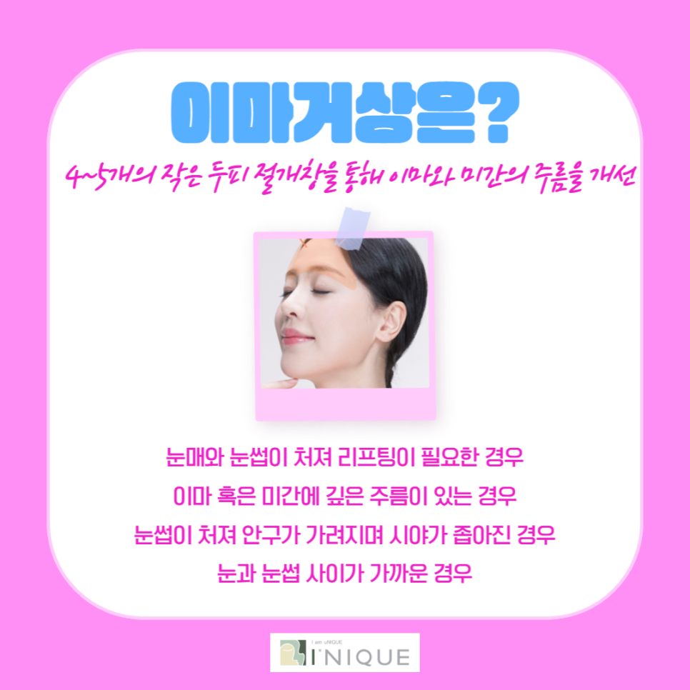 중년동안성형, 자연스럽게 젊음을 되찾는 방법 관련 이미지 4