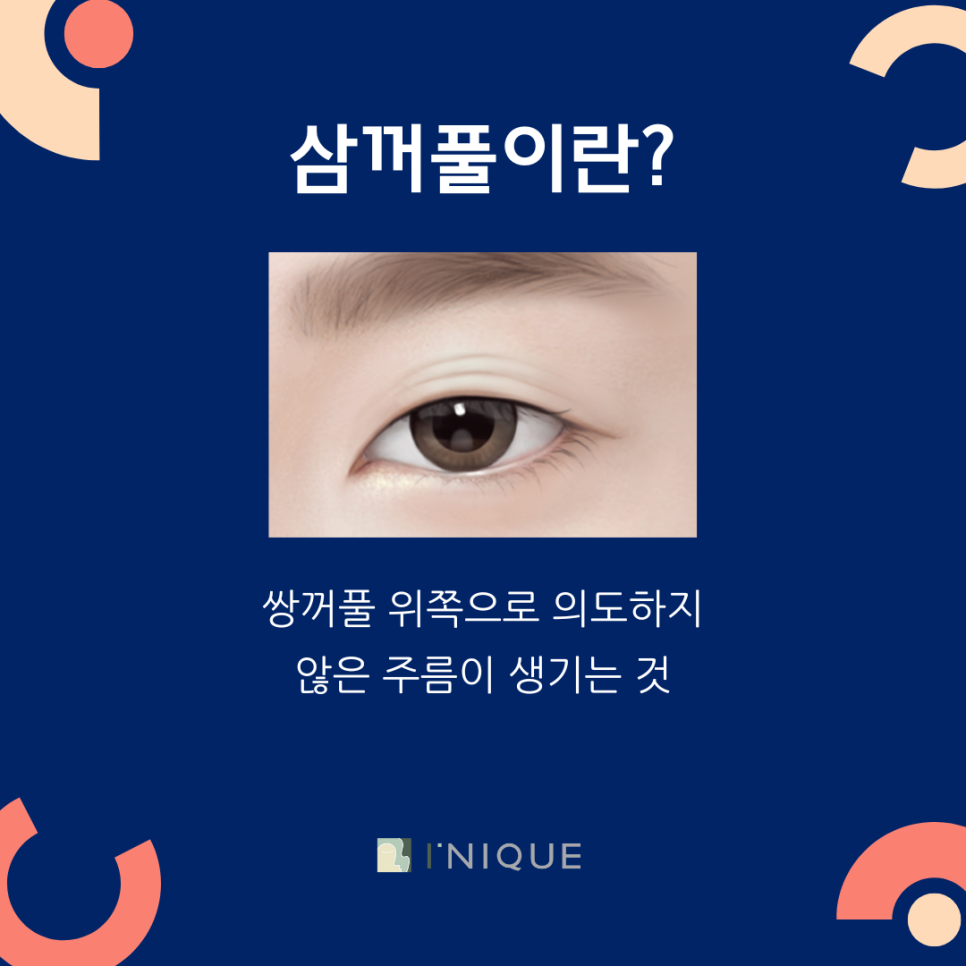 쌍꺼풀 여러겹 해결 하고 싶다면? 관련 이미지 2