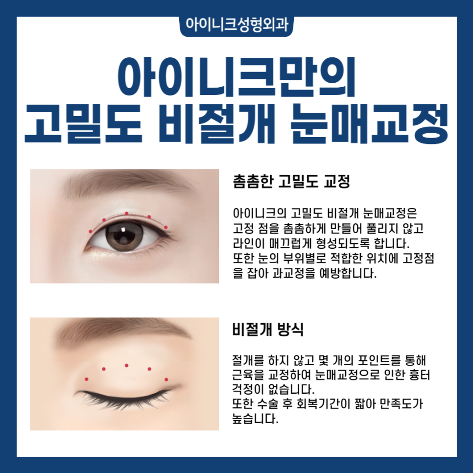 눈매교정수술전후, 또렷한 차이! 관련 이미지 4
