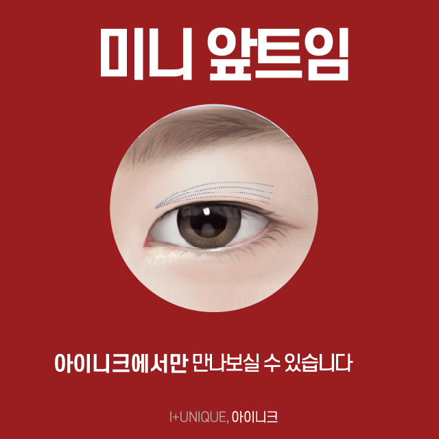또렷하고 긴 눈매를 원하는 남자분들, 밑트임보다 밑뒤트임을 추천드립니다! 관련 이미지 3