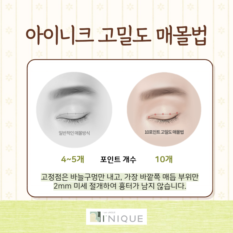 Are You Looking for a Specialized Double Eyelid Plastic Surgery Clinic? image 4