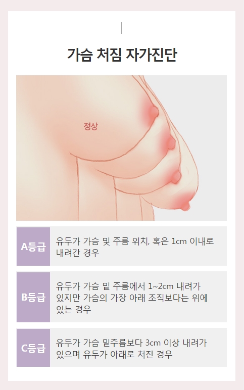 가슴처짐수술비용 궁금하다면 자연스러운 아이니크로! 관련 이미지 2