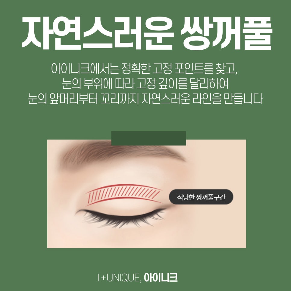 쌍수잘하는병원 아이니크성형외과에서 만드는 또렷한 눈매 관련 이미지 3