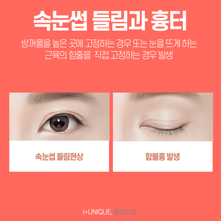성형외과재수술은 보다 신중하게 결정하자 아이니크성형외과에서 관련 이미지 3
