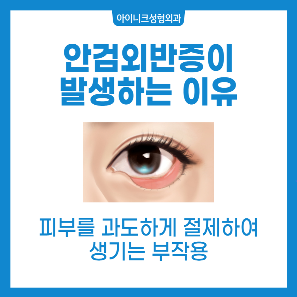 Sagging Eye Surgery: Just Remember These Two Things! image 5