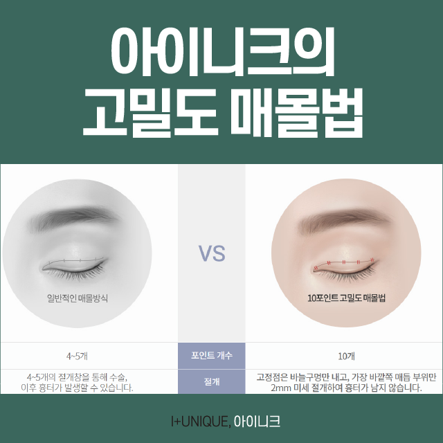 여자첫눈성형 A to Z 관련 이미지 2