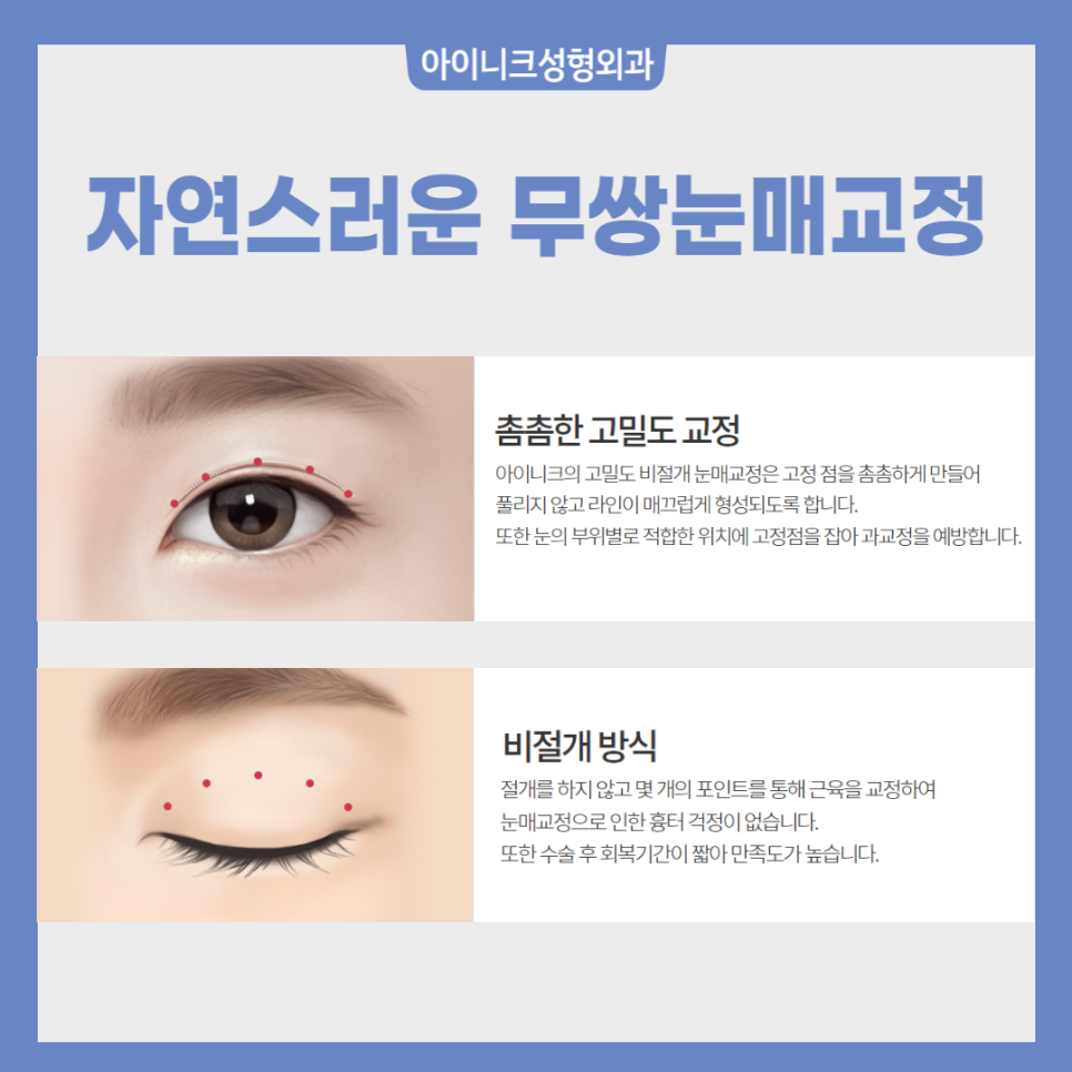 Male Eye Surgery Clinic: Natural and Refined Eye Shape image 5