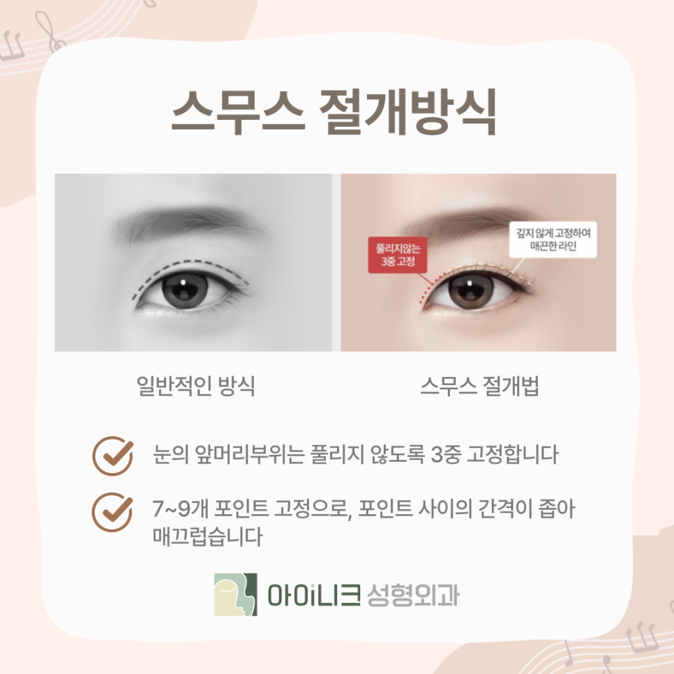 아이들 눈매 원하는 사람~ 연예인 쌍꺼풀의 비밀! 관련 이미지 7