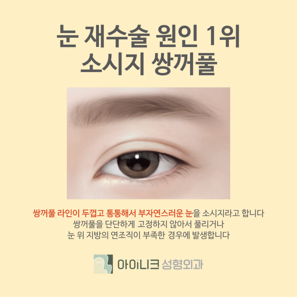Gangnam Eye Revision Surgery Hospital: If You Want to Restore a Failed Double Eyelid image 6