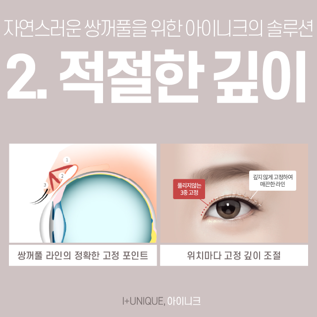 티나는쌍꺼풀은 NO! 자연스러운 쌍꺼풀라인을 만드는 아이니크로 오세요! 관련 이미지 4