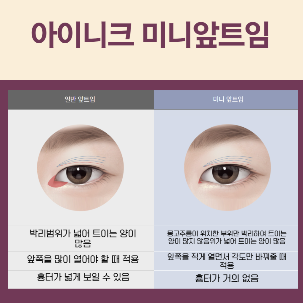 What Should You Check Before Choosing a Famous Plastic Surgery Clinic in Seoul? image 3