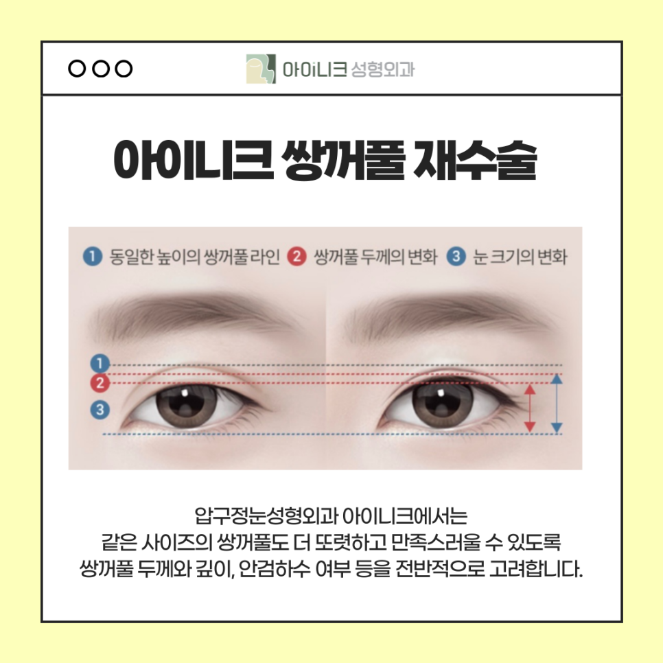 When You’re Looking for an Apgujeong Eye Plastic Surgery Clinic image 4