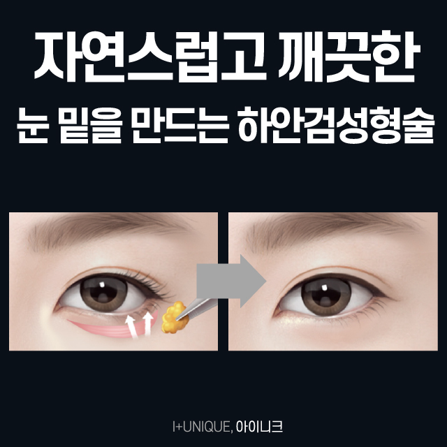 Eyebrow Lift and Lower Blepharoplasty: Back to Your 20s! image 5