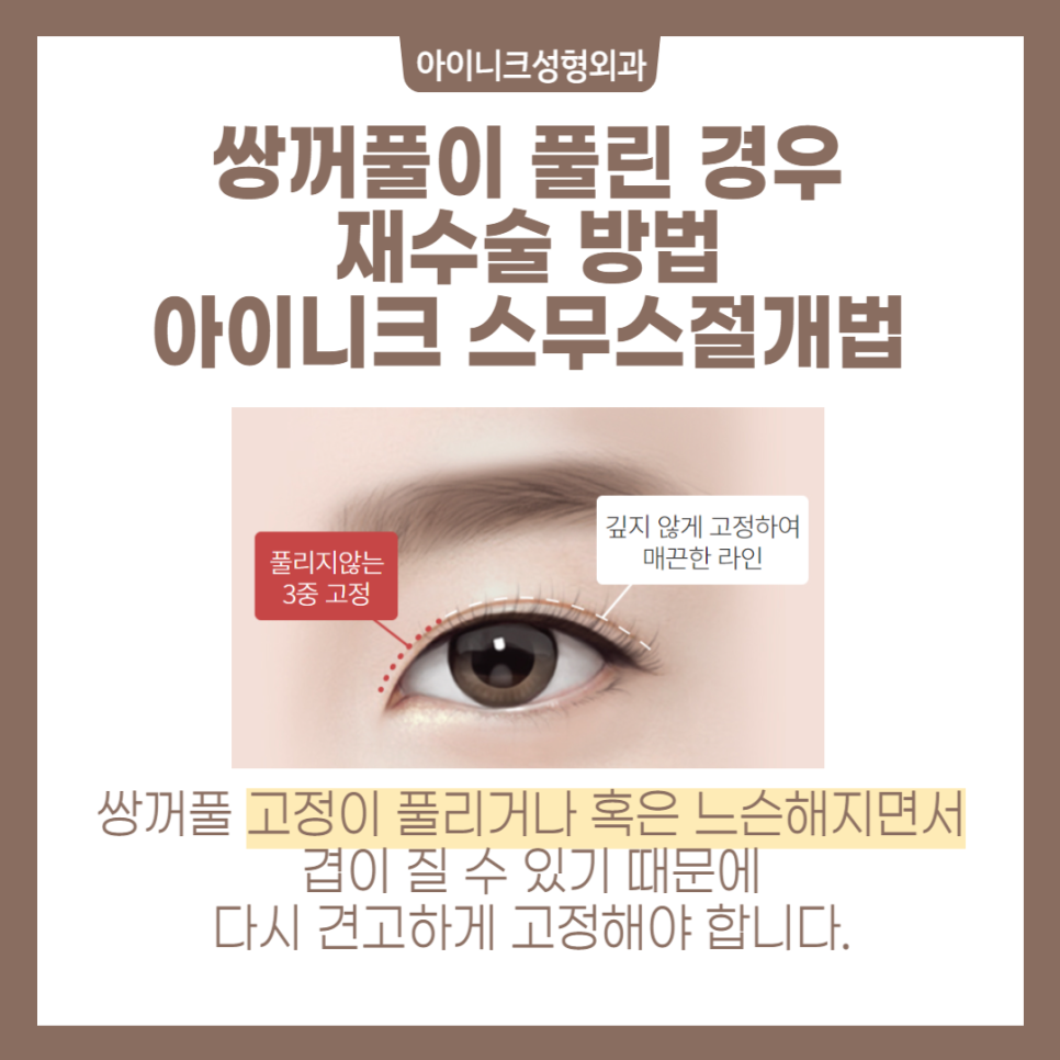 여러겹쌍꺼풀 해결방법을 정확히 알고 싶다면? 관련 이미지 4