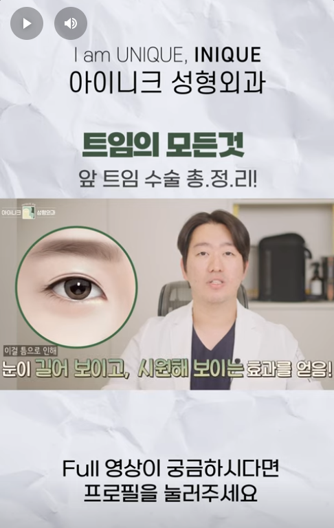 A Complete Guide to Apgujeong Epicanthoplasty!! image 8