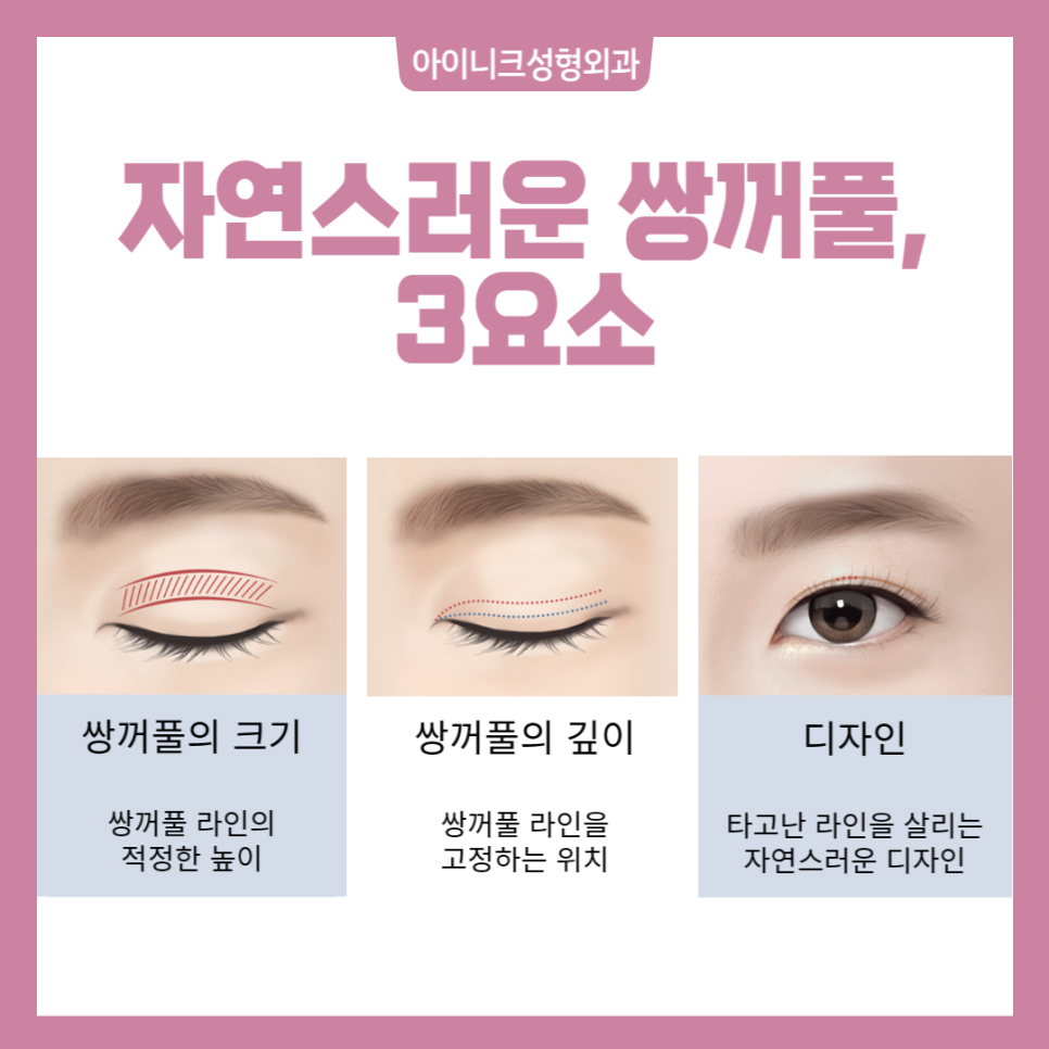 작은눈수술, 자연스러운 쌍꺼풀라인으로 관련 이미지 2