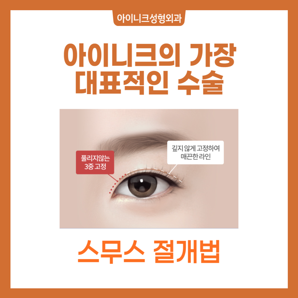 나와 같은 케이스는 없나? 눈성형후기가 궁금하다면 클릭! 관련 이미지 2