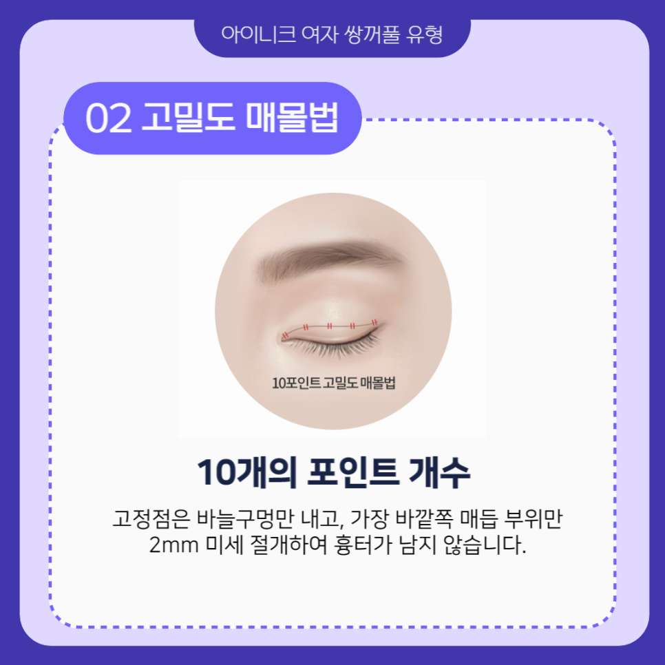 여자쌍꺼풀 나만의 디자인을 찾고있나요? 관련 이미지 3