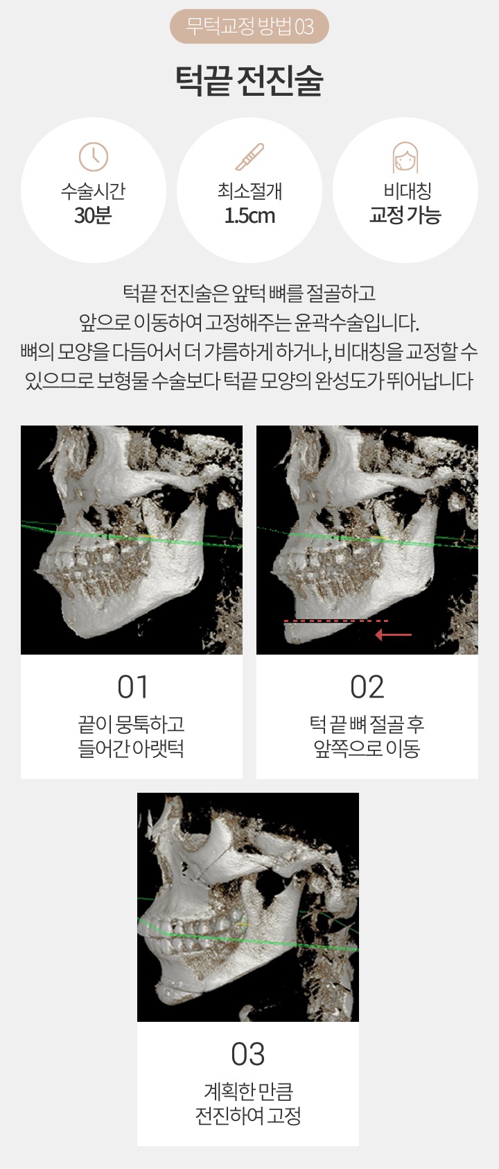 무턱자가진단 같이 체크해볼까요? 관련 이미지 6