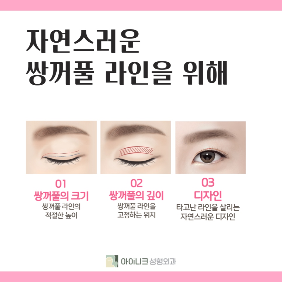 How to Find a Good Double Eyelid Surgery Clinic: Check This! image 3