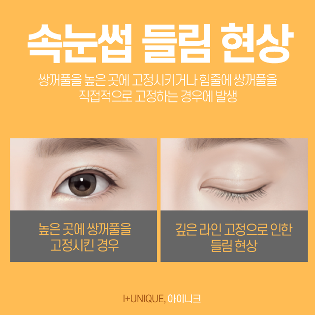속눈썹들림 - 달라진 눈 모양 해결하기 관련 이미지 3