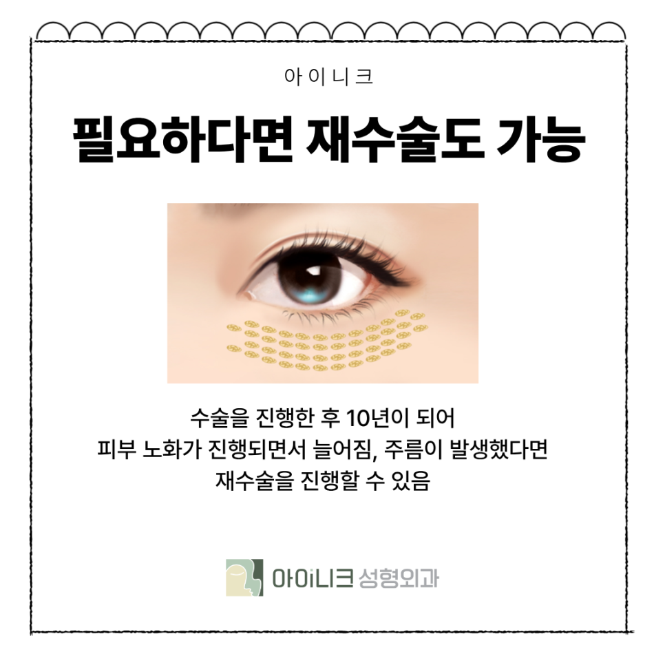 What Is the Appropriate Age for Under-Eye Fat Repositioning Surgery? image 8