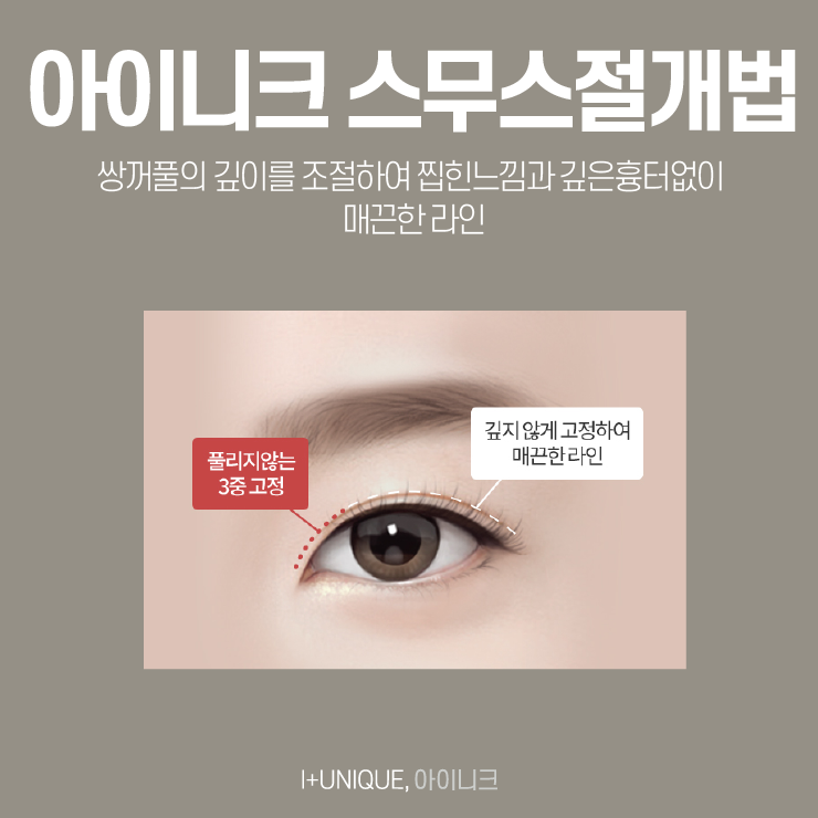 자연스러운쌍꺼풀을 원한다면 아이니크성형외과에서 이것만 확인하자 관련 이미지 4