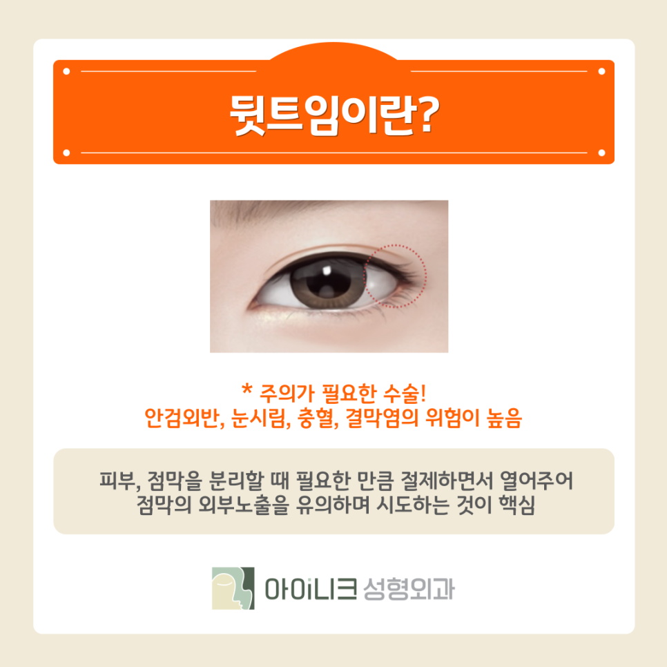 눈꼬리올리기 또렷하고 자연스러운 눈으로 관련 이미지 11