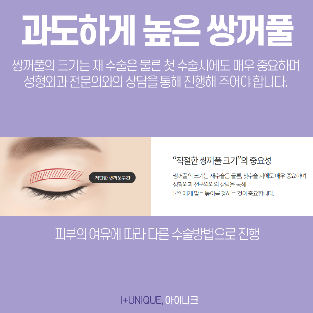 압구정쌍꺼풀재수술, 어떻게 하면 다시 자연스럽게 되돌릴 수 있을까 관련 이미지 3