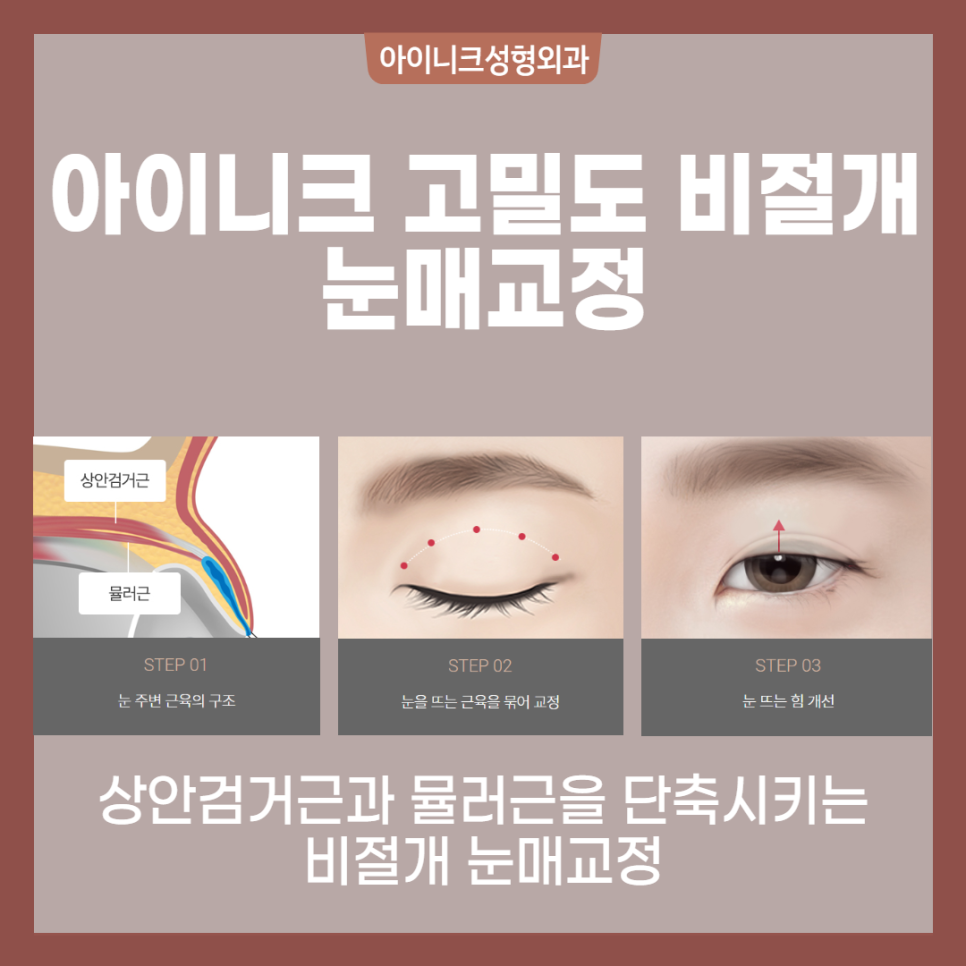 Gangnam Station Ptosis: Looking for a Place That Does It Right? image 4