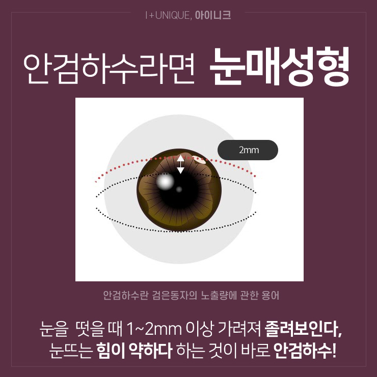 시원하고 또렷해 보이는 눈매성형은 아이니크 에서! 관련 이미지 2