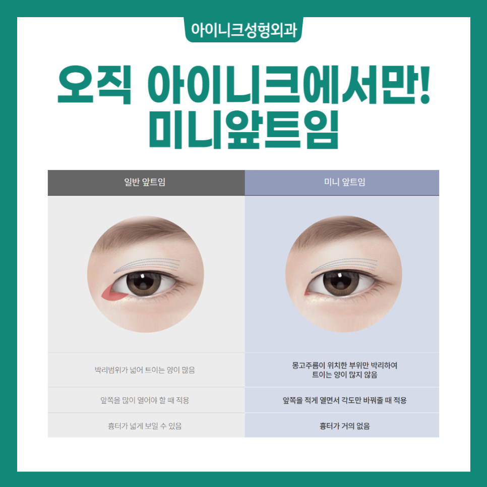 Various Canthoplasty Procedures: Which Design Suits Me Best? image 4