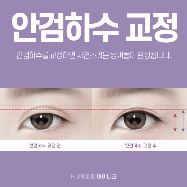 압구정재수술병원을 찾고 있다면 지금 여기!! 관련 이미지 4