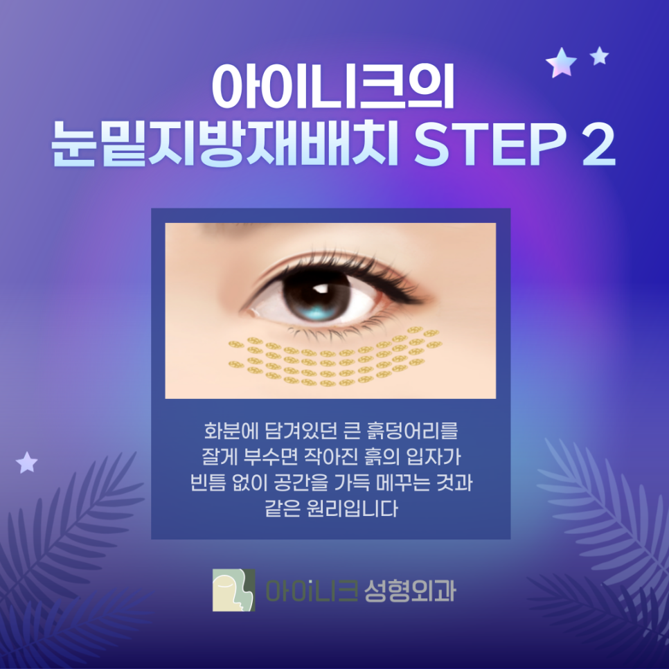 눈밑지방재배치추천병원 제대로 선택하려면? 관련 이미지 5