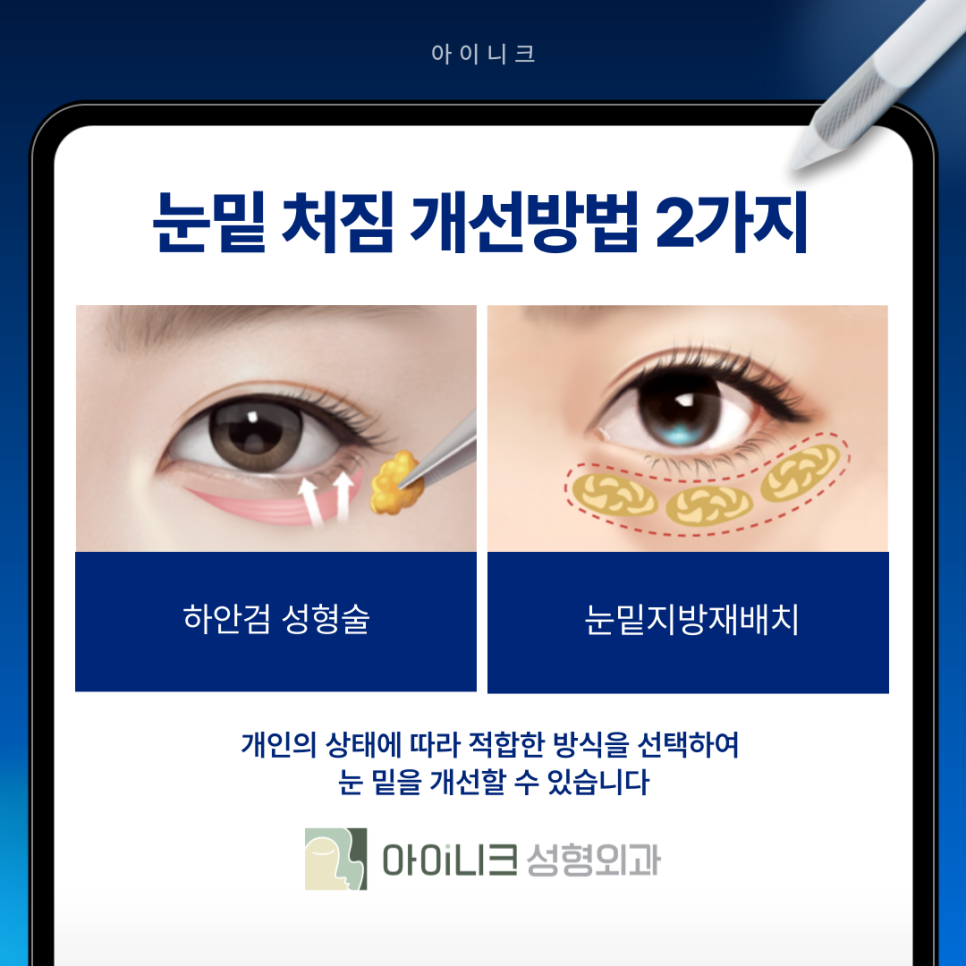 눈밑처짐 해결로 자연스러운 동안 만들기 관련 이미지 6