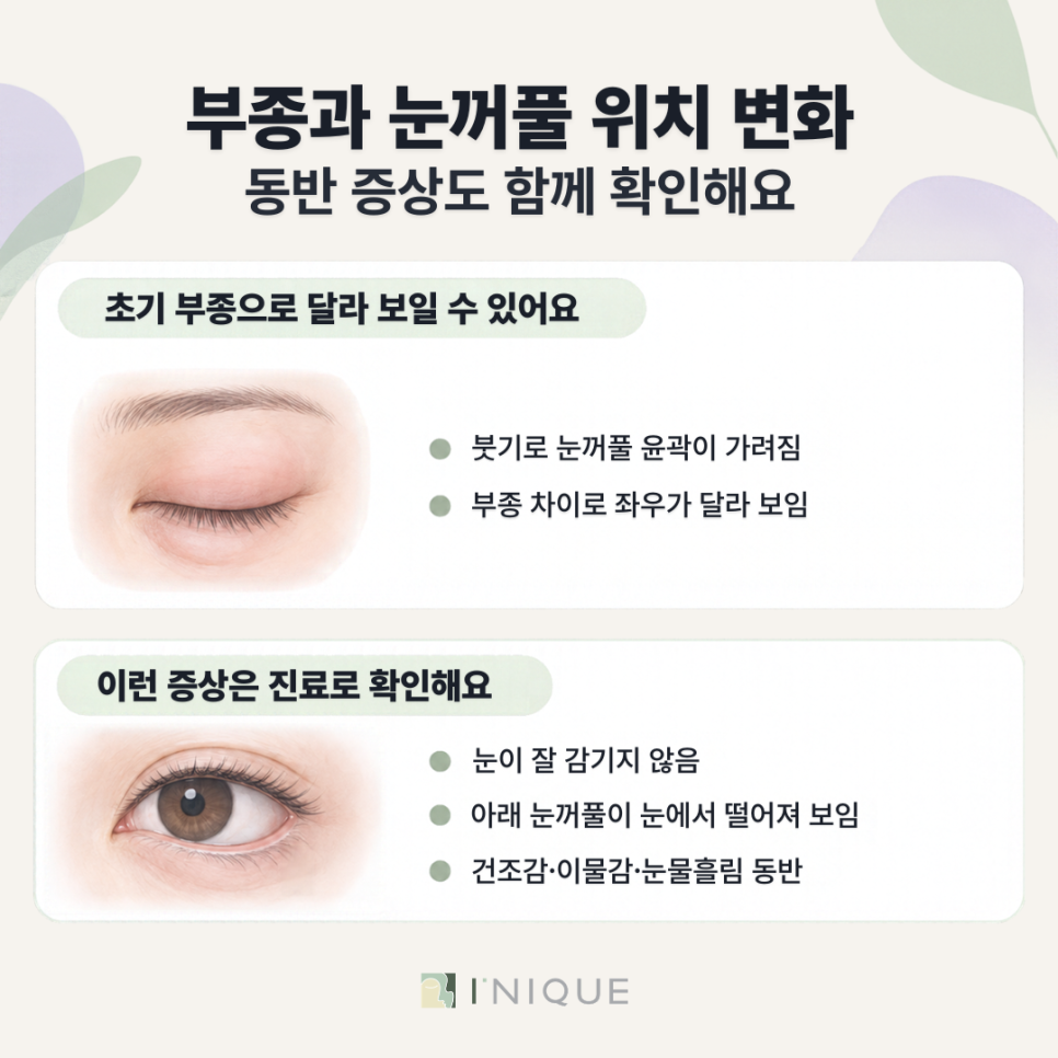 눈밑지 여우눈, 수술 후 눈매 변화의 원인과 확인할 사항 관련 이미지 6