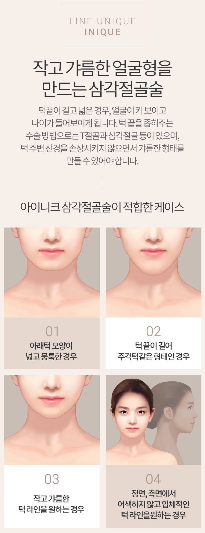 턱끝축소술부작용 없이 안전한 수술 관련 이미지 2