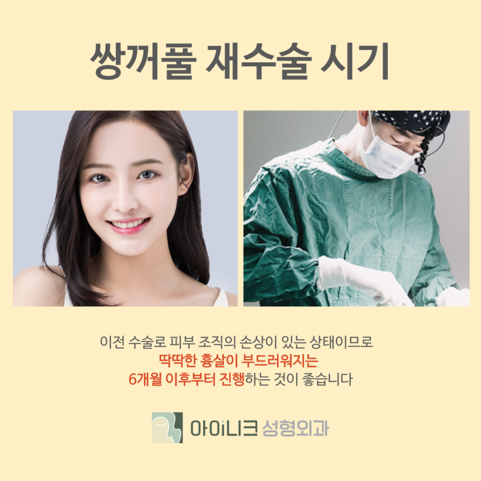 Gangnam Eye Revision Surgery Hospital: If You Want to Restore a Failed Double Eyelid image 5