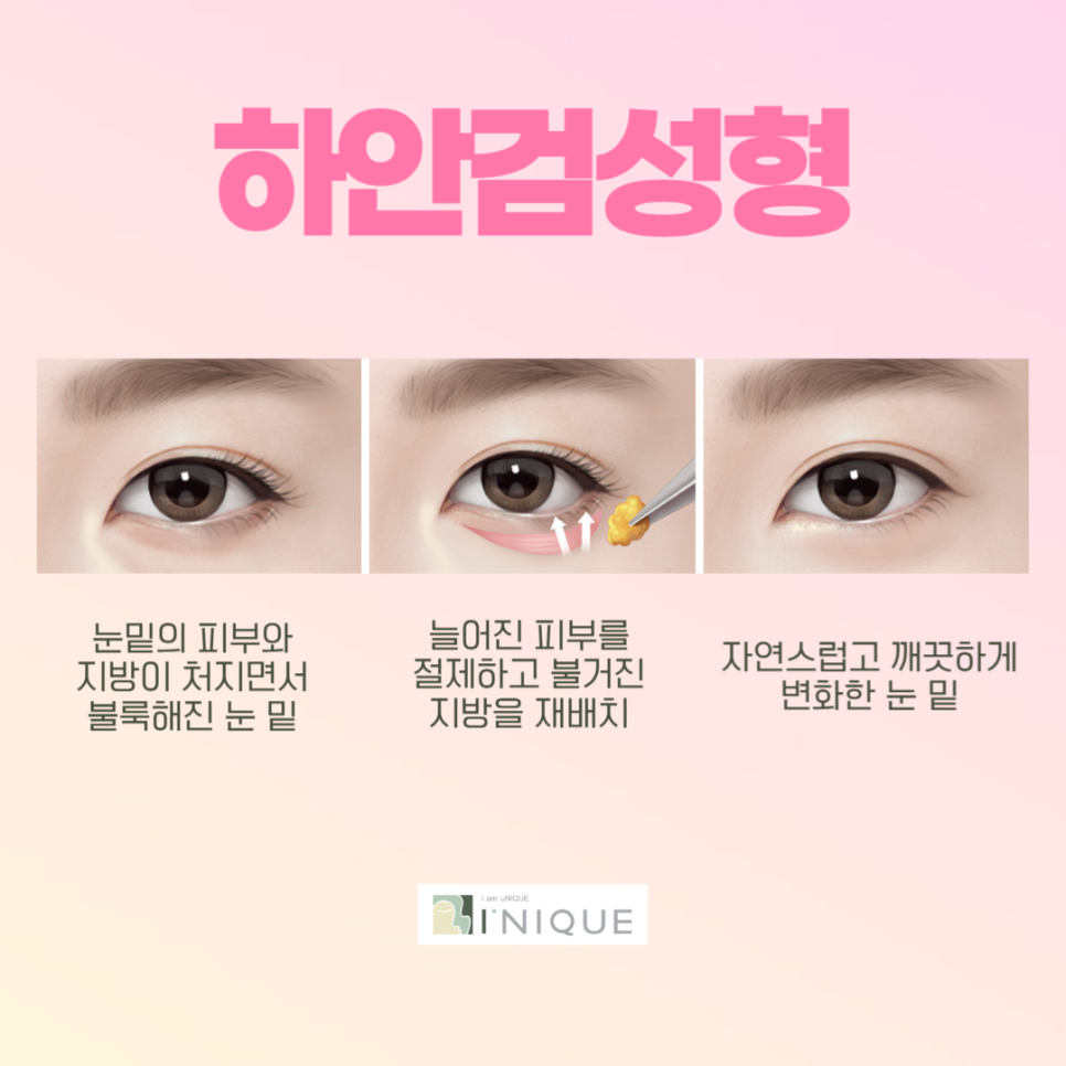I-NIQUE, a Place Known for Good Middle-Aged Eye Surgery image 5