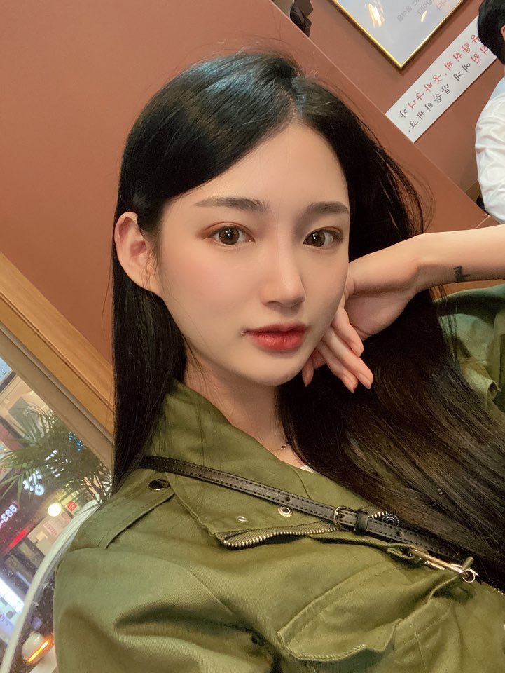 눈밑지방재배치 왜 성형외과 전문의인가 관련 이미지 1